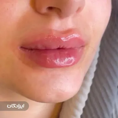 کلینیک زیبایی دیاموند