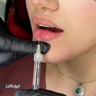 کلینیک زیبایی دکتر احسان شریعتی