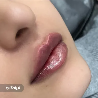 کلینیک زیبایی الماس 