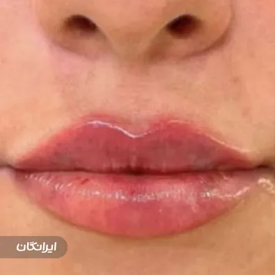 کلینیک زیبایی آریل