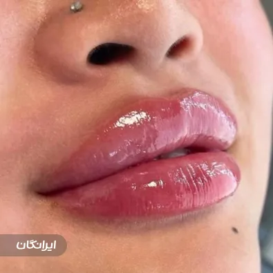 کلینیک زیبایی آریل