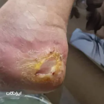 مرکز درمان زخم نوین