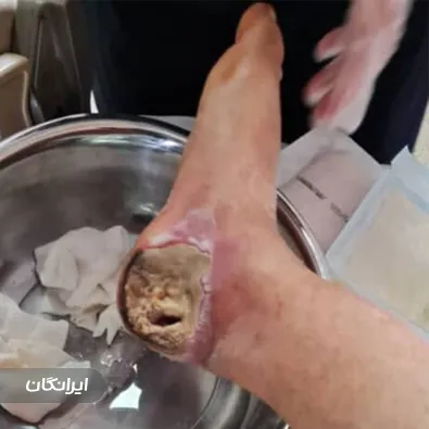 مرکز درمان زخم نوین