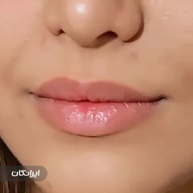 کلینیک زیبایی دکتر آرمان ایزدی