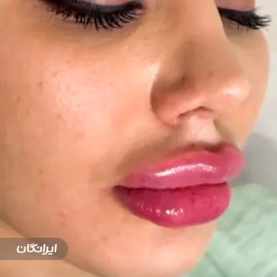 کلینیک زیبایی آوا