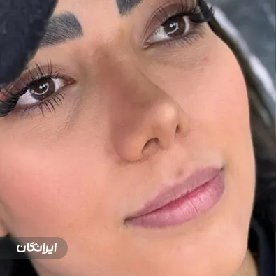 کلینیک زیبایی السارو