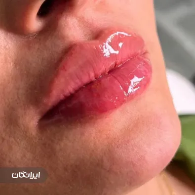 کلینیک زیبایی اسپرینگ
