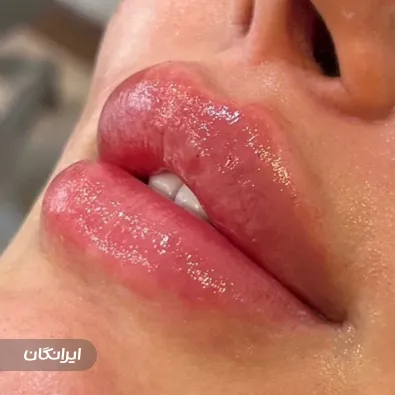 کلینیک زیبایی اسپرینگ
