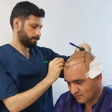 کلینیک کاشت ابرو و مو علیزاده