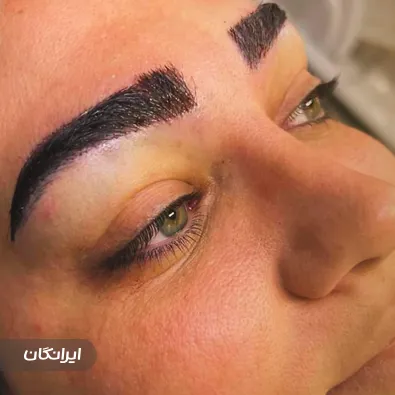 کلینیک زیبایی ایل ماه