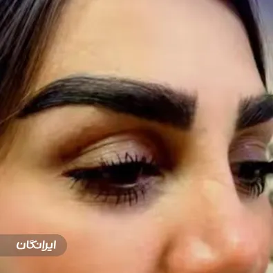 کلینیک زیبایی ایل ماه