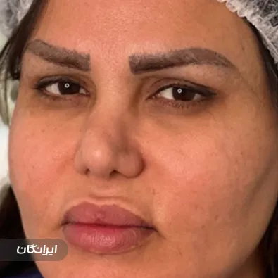 کلینیک کاشت مو ریحانا