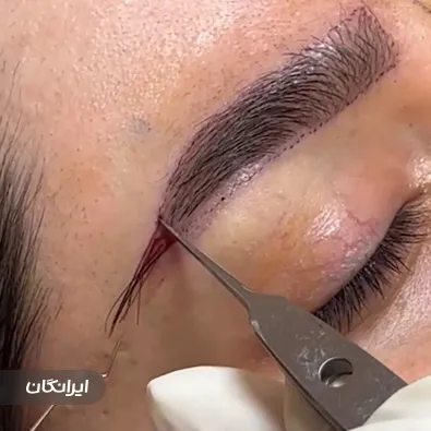 کلینیک زیبایی رویای طلایی