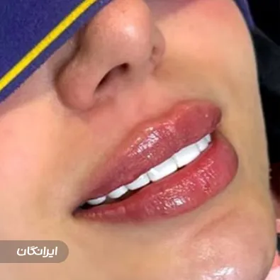 کلینیک زیبایی ایرانیان