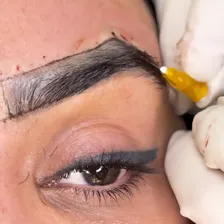 کلینیک زیبایی ساعی پلاس