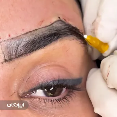 کلینیک زیبایی ساعی پلاس