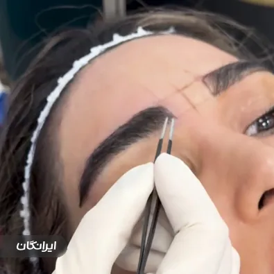 کلینیک زیبایی ساعی پلاس