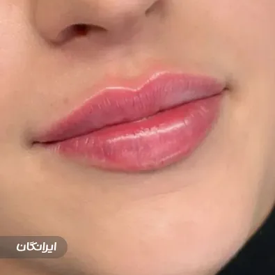 کلینیک زیبایی دکتر تارا حسنی فر