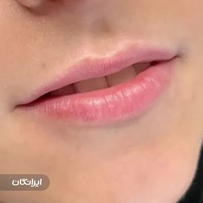 کلینیک زیبایی دکتر تارا حسنی فر