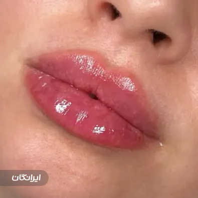 کلینیک زیبایی دکتر تارا حسنی فر