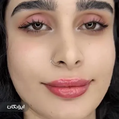 کلینیک زیبایی ژل صورتی