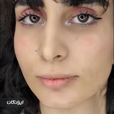 کلینیک زیبایی ژل صورتی