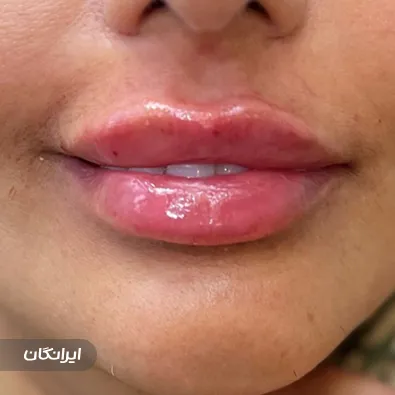 کلینیک زیبایی دکتر نرگس اخوان صباغ