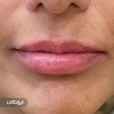 کلینیک زیبایی دکتر نرگس اخوان صباغ