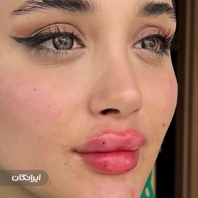 کلینیک زیبایی دکتر نرگس اخوان صباغ