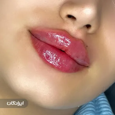 کلینیک زیبایی دکتر میترا قهرمانی