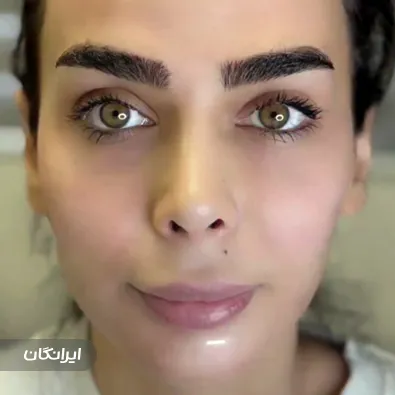 کلینیک زیبایی هانیسا