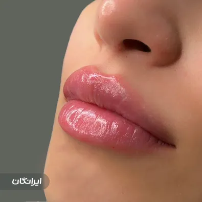 کلینیک زیبایی هانیسا