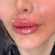 کلینیک زیبایی اپال