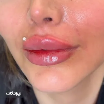 کلینیک زیبایی اپال