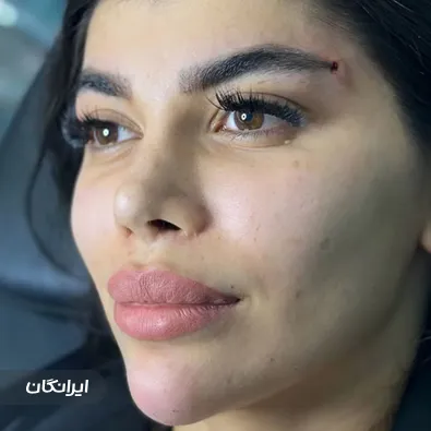 کلینیک زیبایی اپال