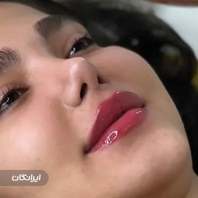 کلینیک زیبایی دکتر هدیه حاتمی