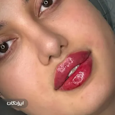 کلینیک زیبایی دکتر هدیه حاتمی