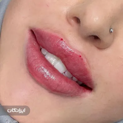 کلینیک زیبایی لونا