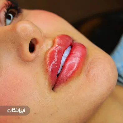 کلینیک زیبایی لونا