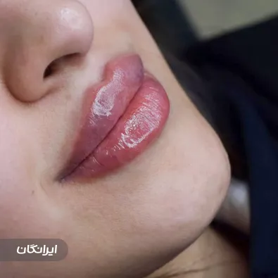 کلینیک زیبایی لونا