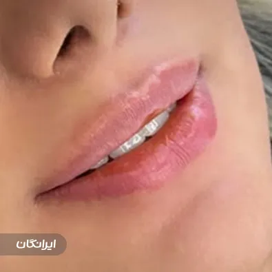 کلینیک زیبایی سرندی پیتی