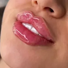 کلینیک زیبایی سرندی پیتی