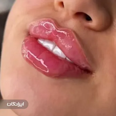 کلینیک زیبایی سرندی پیتی