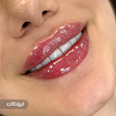 کلینیک زیبایی دکتر شقایق مهرآذین