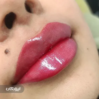 کلینیک زیبایی دکتر شقایق مهرآذین