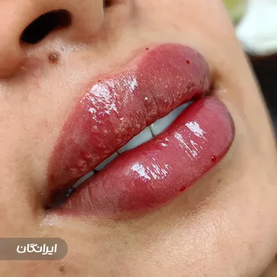 کلینیک زیبایی دکتر شقایق مهرآذین