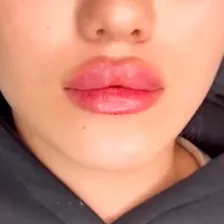 کلینیک زیبایی الارز