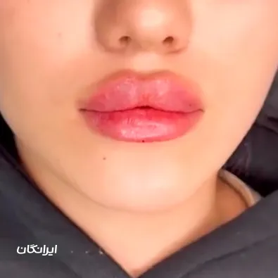 کلینیک زیبایی الارز