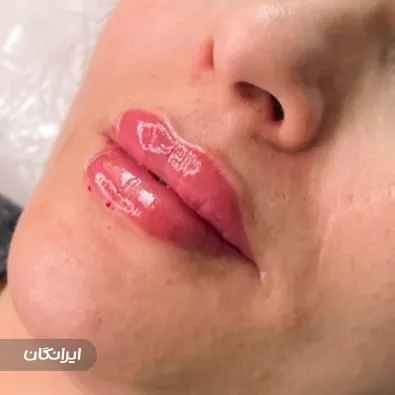 کلینیک زیبایی الارز