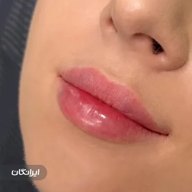 کلینیک زیبایی الارز